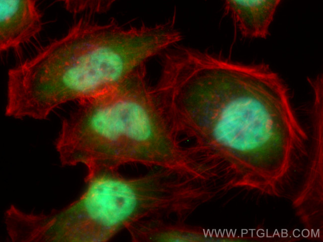 PI3 Kinase p85 Beta Antibody in Immunocytochemistry (ICC/IF)