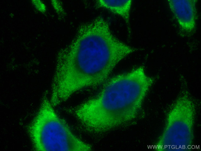 CYR61 Antibody in Immunocytochemistry (ICC/IF)