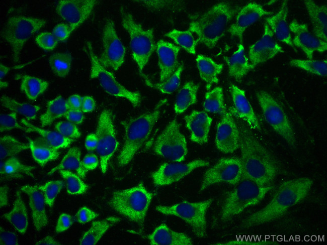 PROCR Antibody in Immunocytochemistry (ICC/IF)