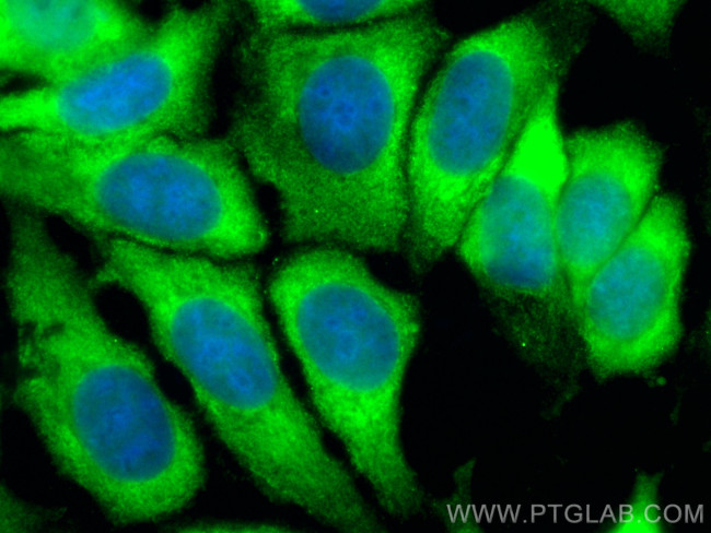 HARS Antibody in Immunocytochemistry (ICC/IF)