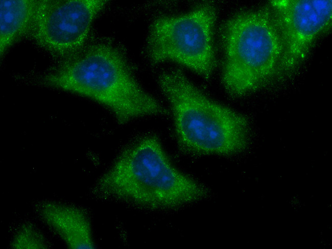 IMPDH2 Antibody in Immunocytochemistry (ICC/IF)
