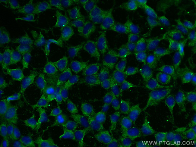 MTHFD1 Antibody in Immunocytochemistry (ICC/IF)