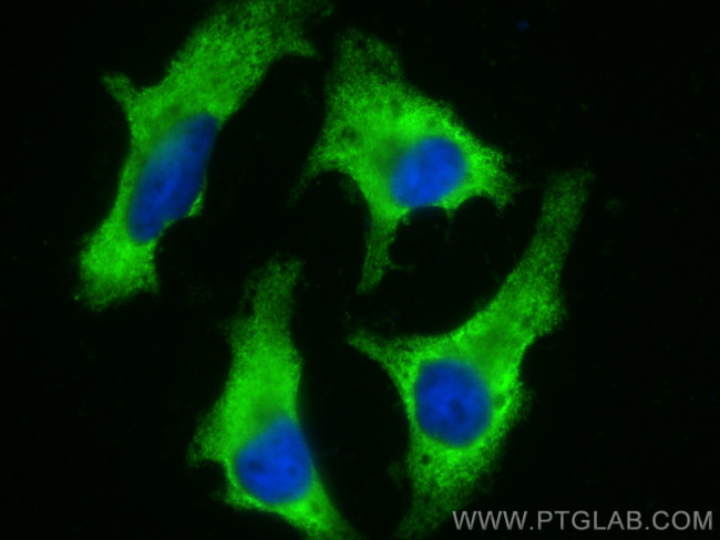 EIF2AK1 Antibody in Immunocytochemistry (ICC/IF)