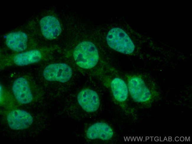 PSMD5 Antibody in Immunocytochemistry (ICC/IF)