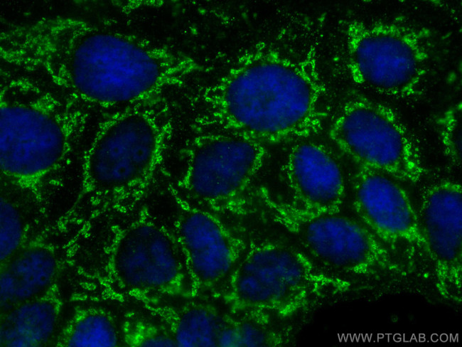 SLC6A12 Antibody in Immunocytochemistry (ICC/IF)