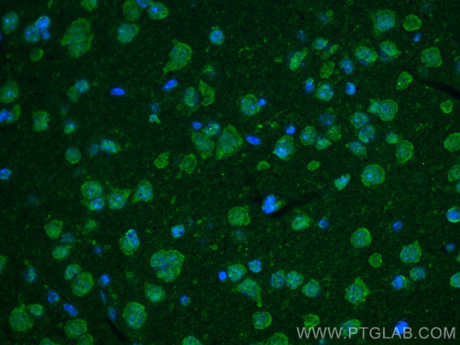 TNC/Tenascin-C Antibody in Immunohistochemistry (PFA fixed) (IHC (PFA))