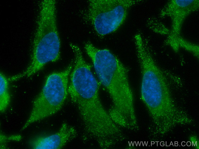 NARS Antibody in Immunocytochemistry (ICC/IF)