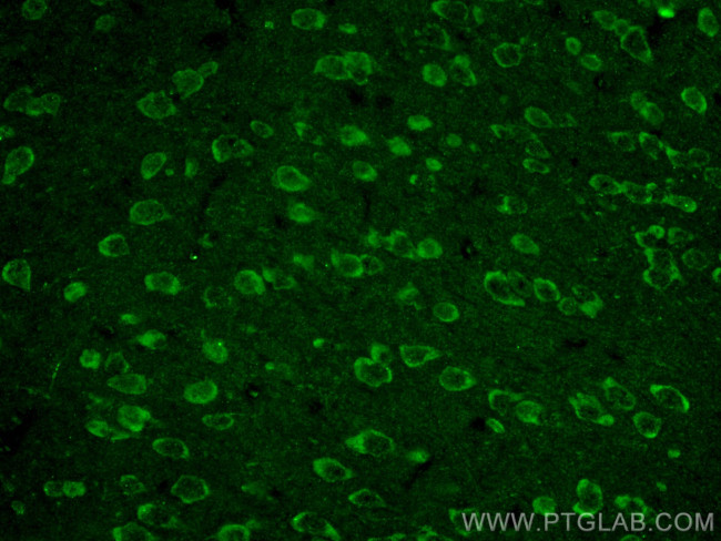 NMDAR1/GRIN1 Antibody in Immunohistochemistry (PFA fixed) (IHC (PFA))
