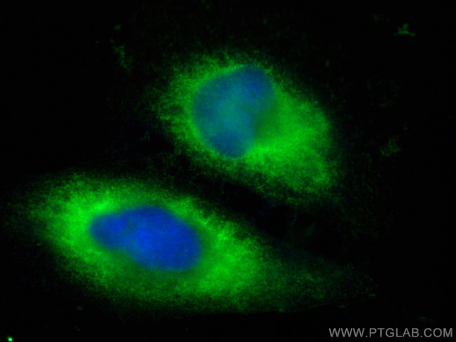 ATG4B Antibody in Immunocytochemistry (ICC/IF)