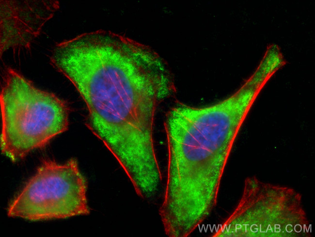 HK3 Antibody in Immunocytochemistry (ICC/IF)