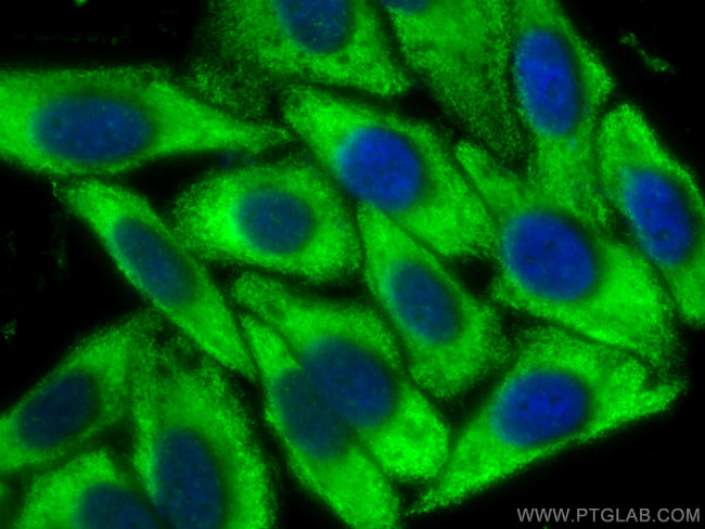 PSMD13 Antibody in Immunocytochemistry (ICC/IF)