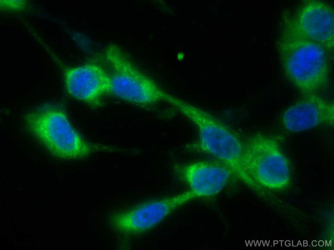 VAMP2 Antibody in Immunocytochemistry (ICC/IF)