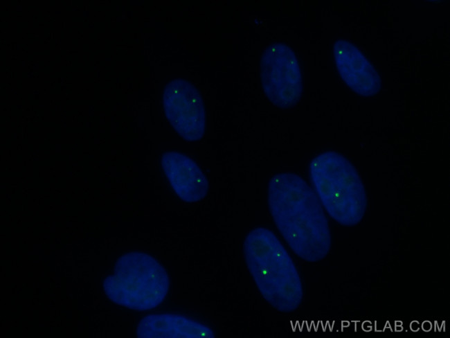 TOE1 Antibody in Immunocytochemistry (ICC/IF)