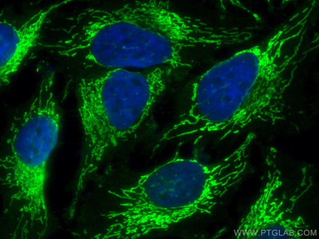 OXCT1 Antibody in Immunocytochemistry (ICC/IF)