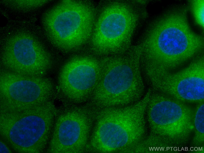 RAB1B Antibody in Immunocytochemistry (ICC/IF)