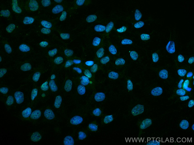 DAXX Antibody in Immunocytochemistry (ICC/IF)