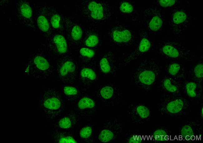 CDK7 Antibody in Immunocytochemistry (ICC/IF)