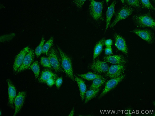 KPNA3 Antibody in Immunocytochemistry (ICC/IF)