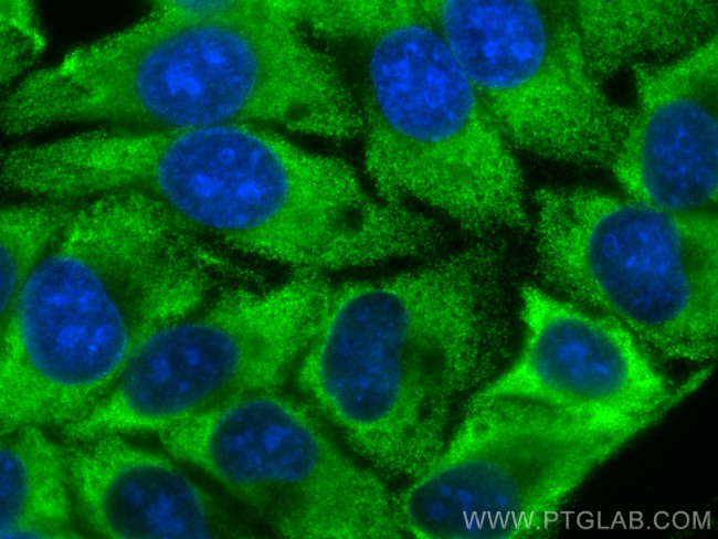 EIF5A2 Antibody in Immunocytochemistry (ICC/IF)