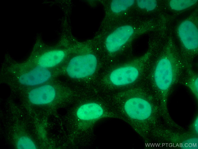 NXF1 Antibody in Immunocytochemistry (ICC/IF)