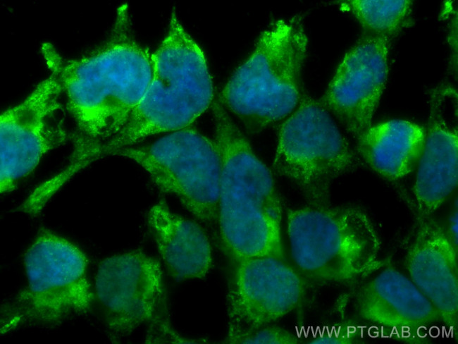 USP10 Antibody in Immunocytochemistry (ICC/IF)