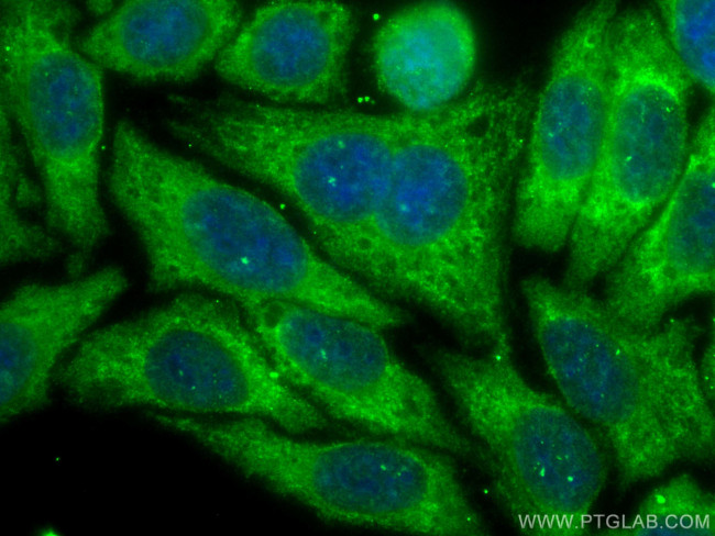 FAM114A1 Antibody in Immunocytochemistry (ICC/IF)