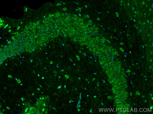 MFSD2 Antibody in Immunohistochemistry (PFA fixed) (IHC (PFA))