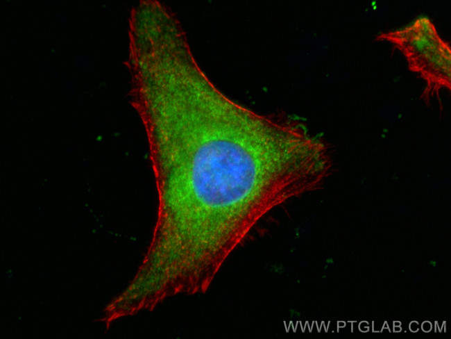 LIMK1 Antibody in Immunocytochemistry (ICC/IF)