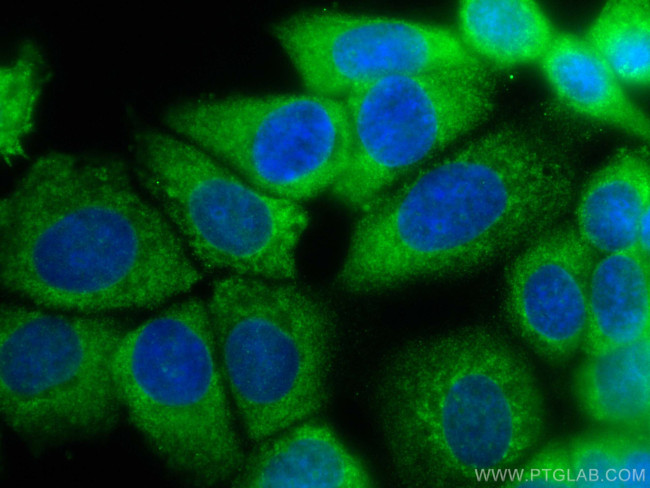 ARHGEF16 Antibody in Immunocytochemistry (ICC/IF)