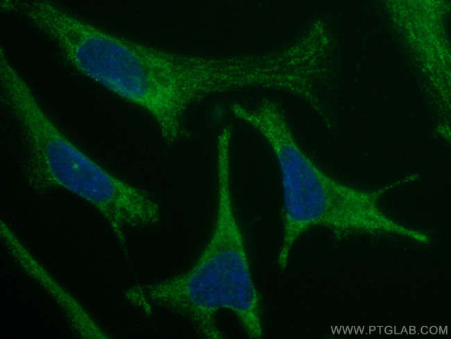 MON1B Antibody in Immunocytochemistry (ICC/IF)