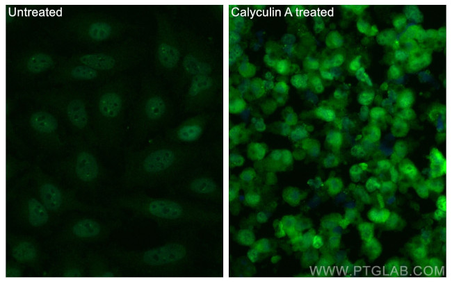 Phospho-MEK1 (Thr386) Antibody in Immunocytochemistry (ICC/IF)