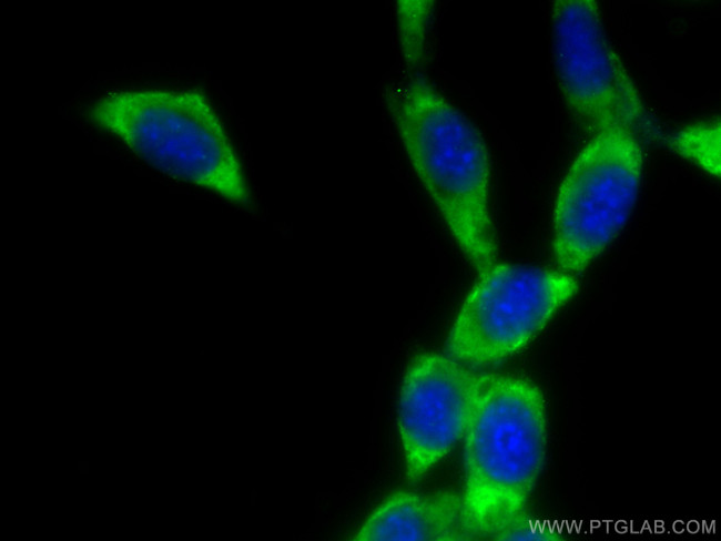 DUSP22 Antibody in Immunocytochemistry (ICC/IF)