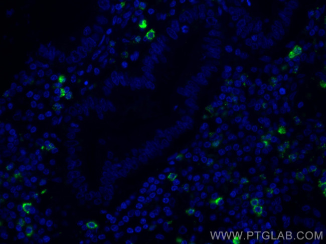 CR1 Antibody in Immunohistochemistry (PFA fixed) (IHC (PFA))