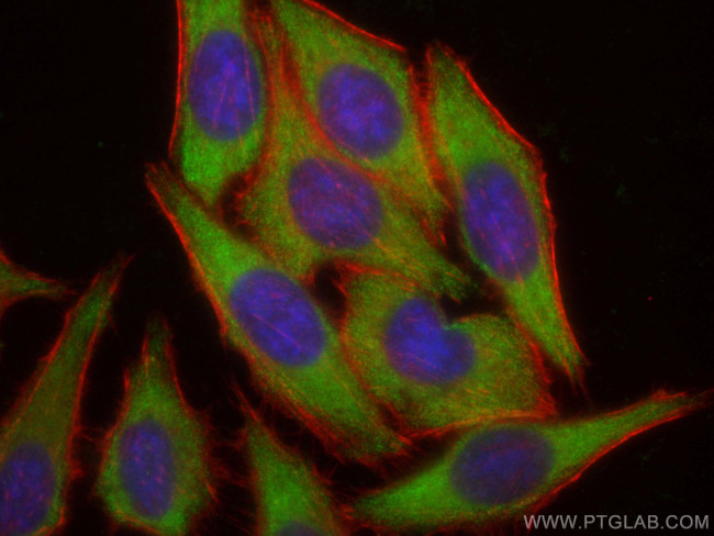 ZFP36L1 Antibody in Immunocytochemistry (ICC/IF)