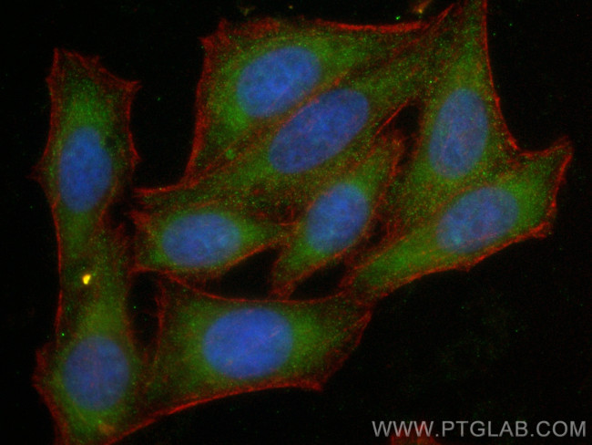 HTRA1 Antibody in Immunocytochemistry (ICC/IF)
