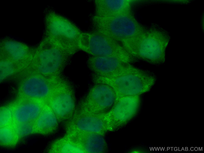 STRA8 Antibody in Immunocytochemistry (ICC/IF)