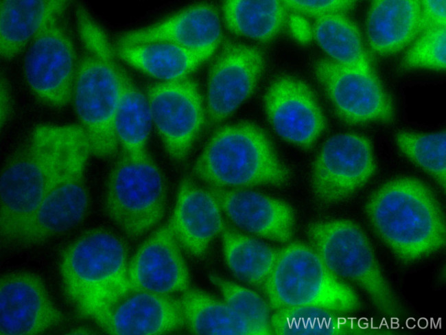 TPD52L2 Antibody in Immunocytochemistry (ICC/IF)