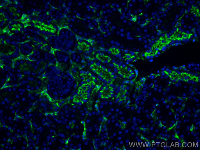 DPEP1 Antibody in Immunohistochemistry (PFA fixed) (IHC (PFA))