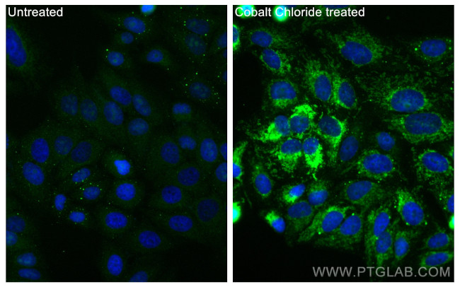 BNIP3 Antibody in Immunocytochemistry (ICC/IF)