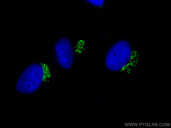 p115, USO1 Antibody in Immunocytochemistry (ICC/IF)