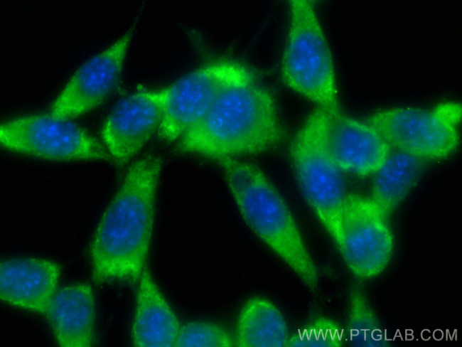 Bcl2 Antibody in Immunocytochemistry (ICC/IF)