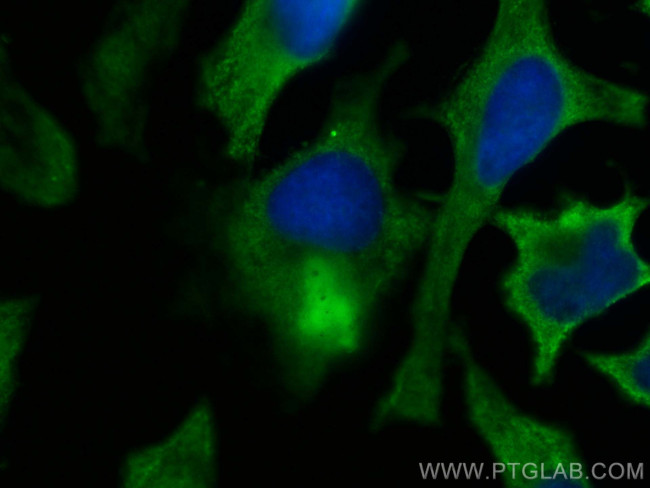 CEP89, CCDC123 Antibody in Immunocytochemistry (ICC/IF)
