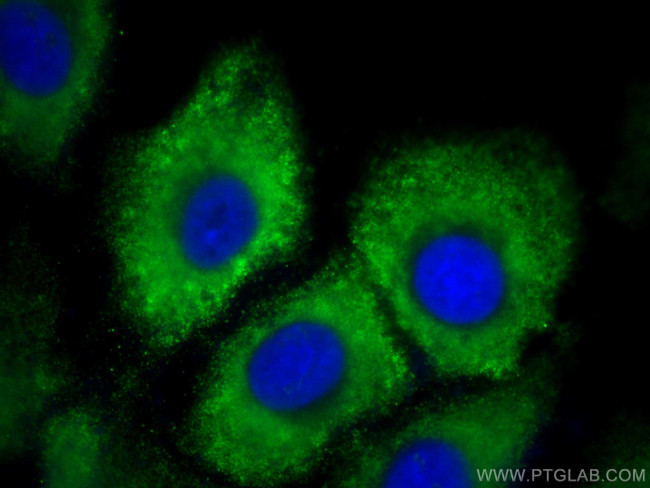 DCT Antibody in Immunocytochemistry (ICC/IF)