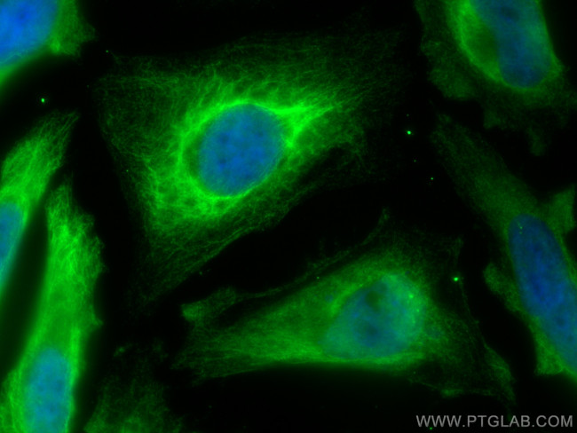 BNIP3L Antibody in Immunocytochemistry (ICC/IF)