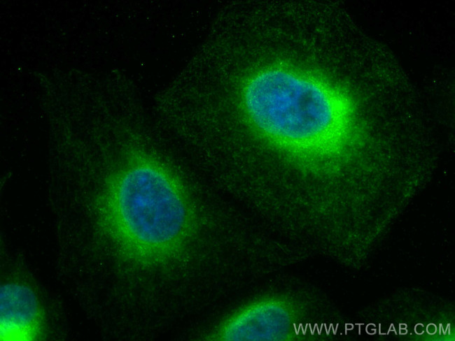 REEP5 Antibody in Immunocytochemistry (ICC/IF)