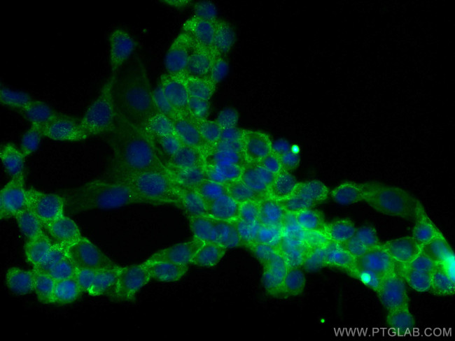 Dystrophin Antibody in Immunocytochemistry (ICC/IF)