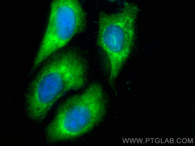 MAN1B1 Antibody in Immunocytochemistry (ICC/IF)