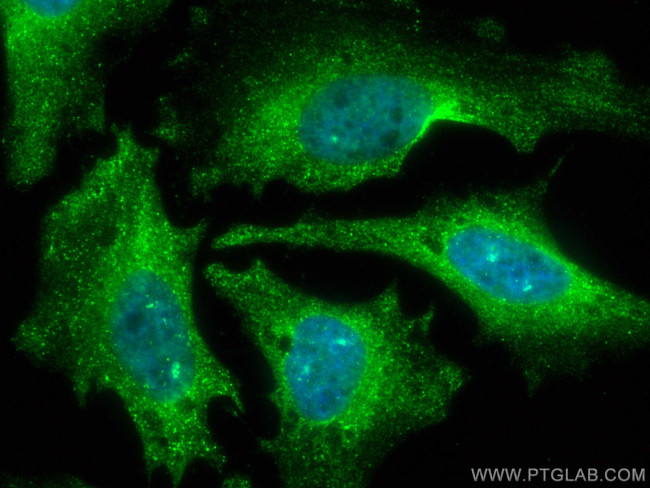PPP1CC Antibody in Immunocytochemistry (ICC/IF)