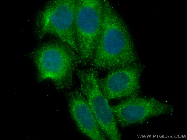 PSMA8 Antibody in Immunocytochemistry (ICC/IF)