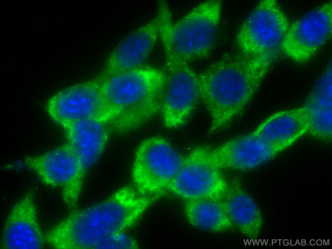 LPIN1 Antibody in Immunocytochemistry (ICC/IF)